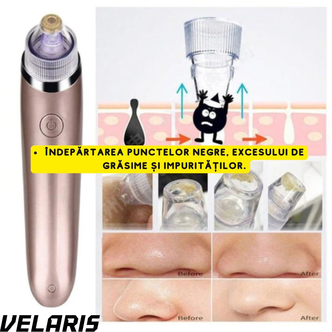Aparat Vacuum Presure Cleaner pentru Curatarea Tenului, Puncte Negre si Grasime