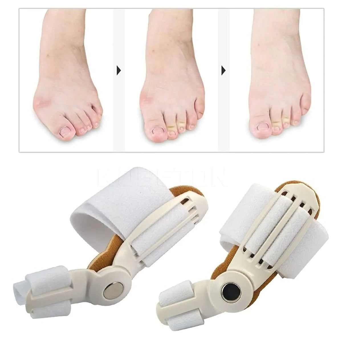 Corector bunion cu separator deget, sprijin ortopedic ajustabil, universal