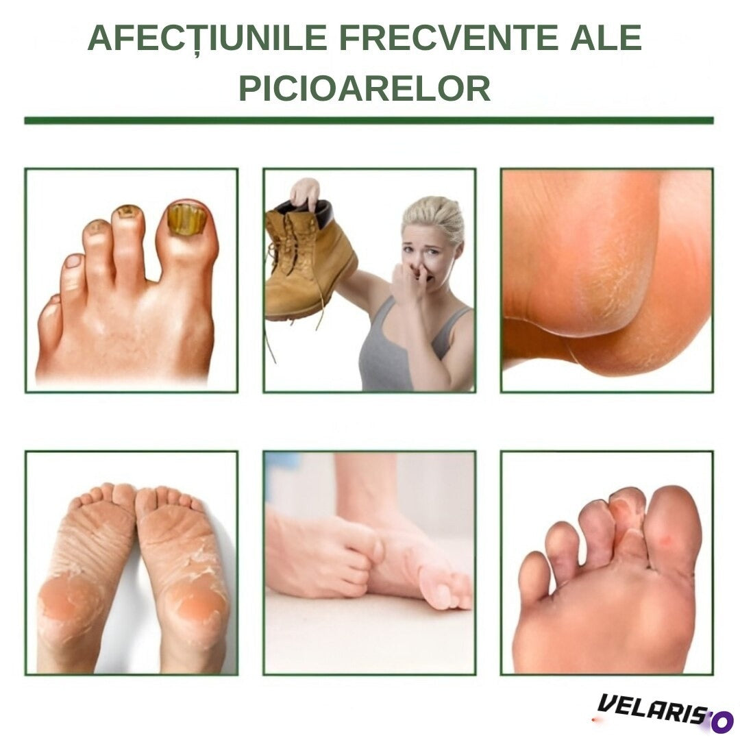 Șosete mască exfoliantă pentru picioare, 1 pereche, hidratare intensă, piele mătăsoasă și calmă