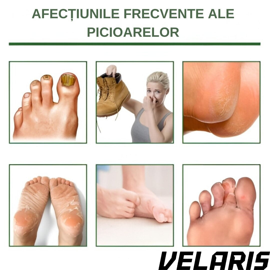 Sosete cu masca exfolianta pentru picioare, 1 pereche, hidratare intensa, exfoliere delicata, eliminarea mirosurilor, ingrijire naturala pentru piele catifelata