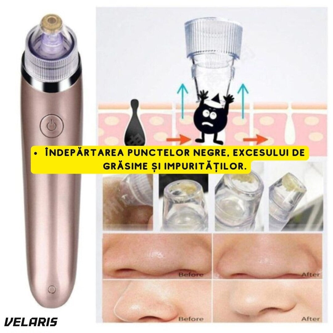 Dispozitiv de curățare a porilor cu vacuum și presiune, pentru puncte negre